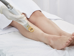 Laser Hair Removal