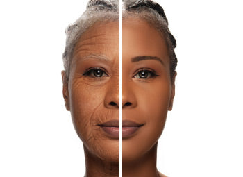GENERAL AGEING – SAGGING