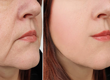 JOWLS