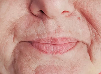 NOSE TO MOUTH – LINES