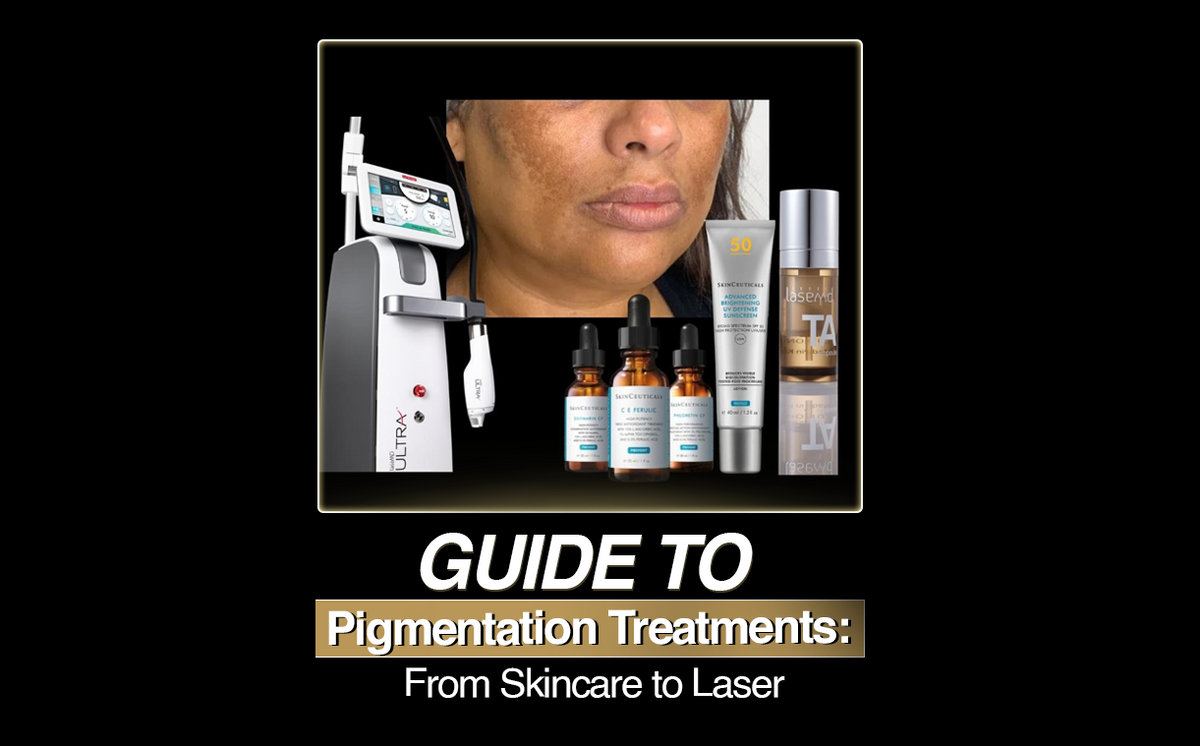 The Ultimate Guide to Pigmentation Treatments: From Skincare to Laser
