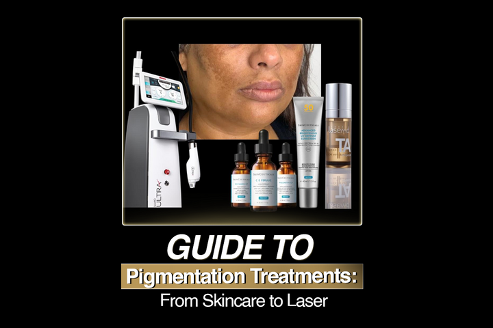 The Ultimate Guide to Pigmentation Treatments: From Skincare to Laser