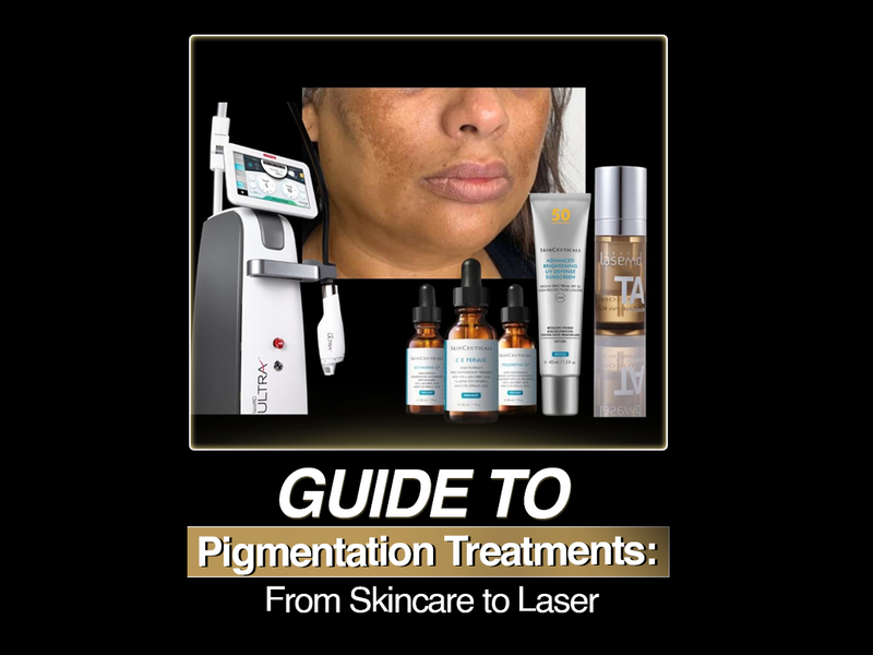 The Ultimate Guide to Pigmentation Treatments: From Skincare to Laser