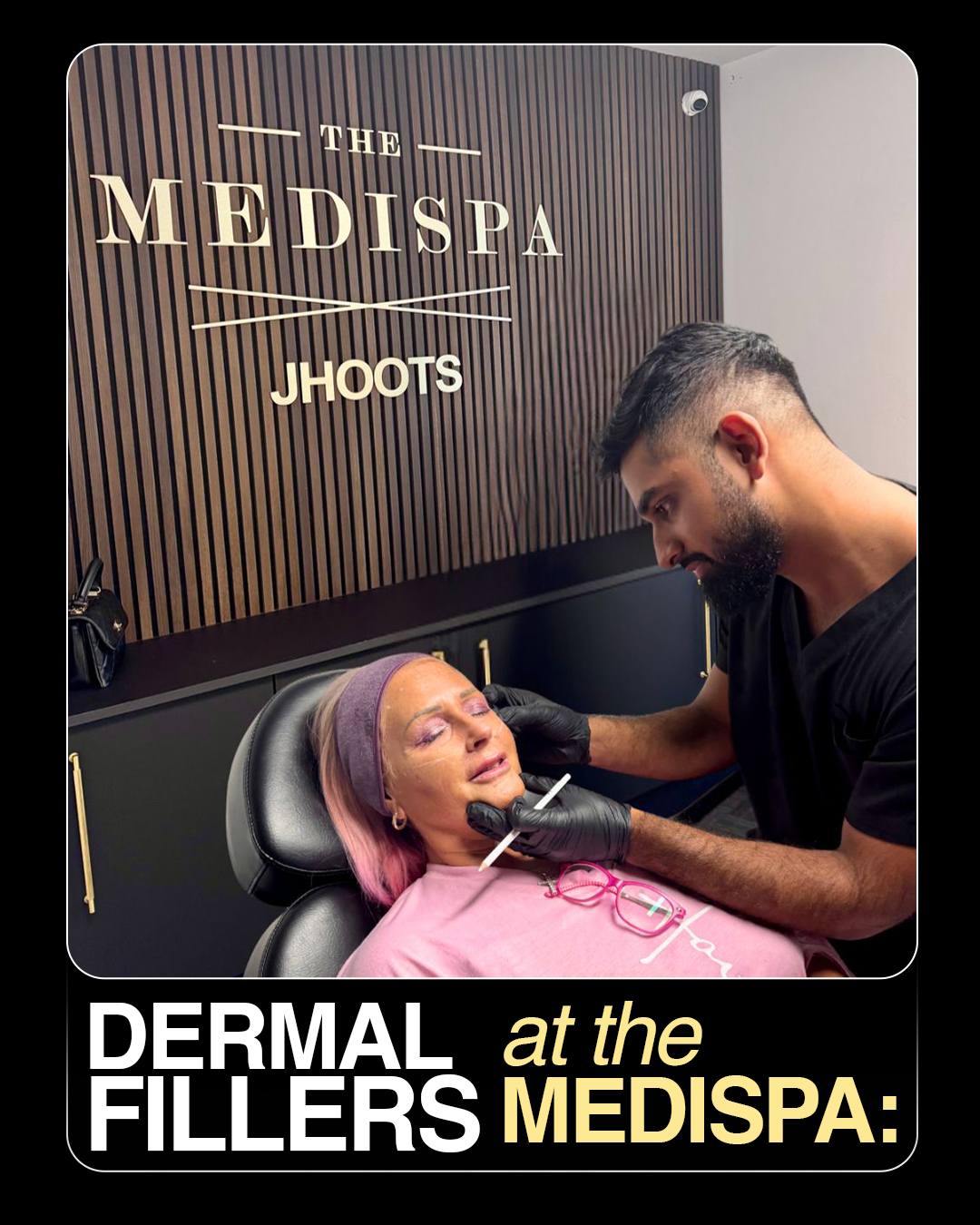 Dermal Fillers in Telford, Shrewsbury, Wolverhampton & Walsall | The Medispa
