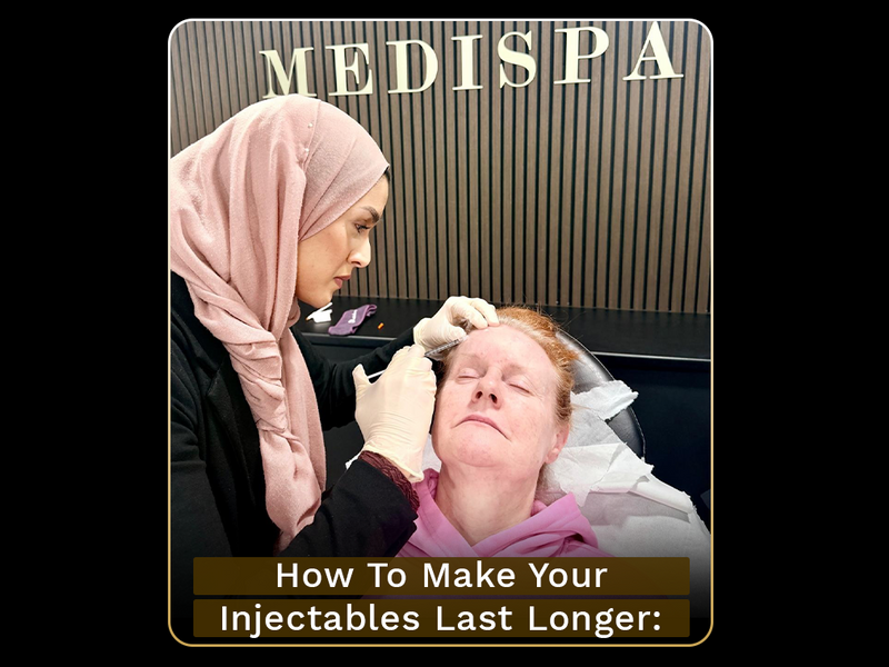 How to Make Your Injectables Last Longer | The Medispa Tips
