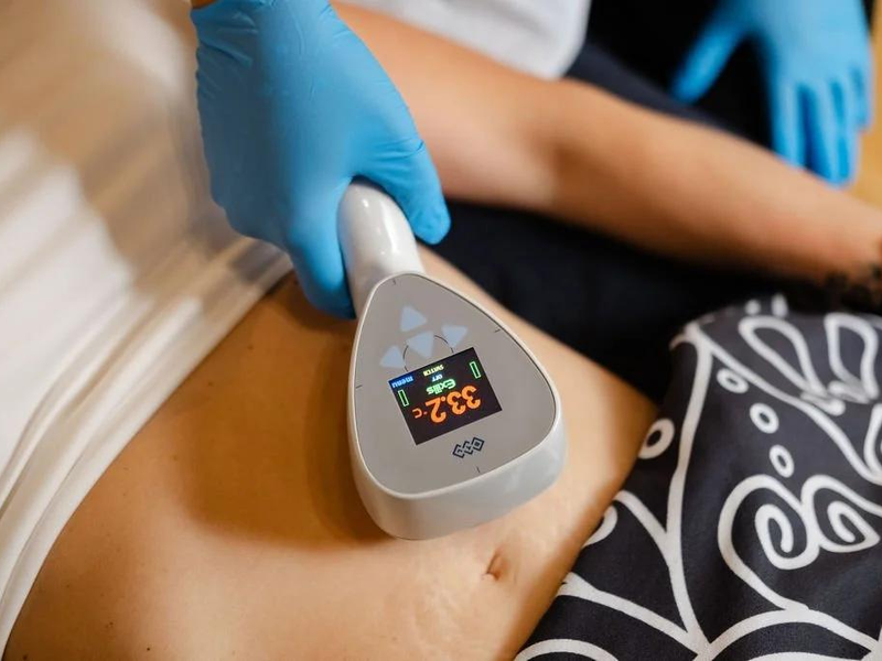BTL Exilis Explained: Why Heating the Skin Can Tighten and Reshape the Body