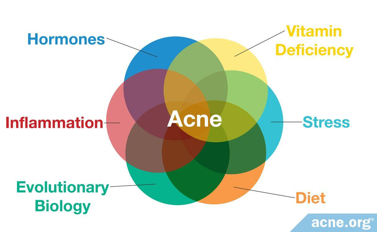 Treating Acne Properly: Why Over-the-Counter Isn't Always Enough