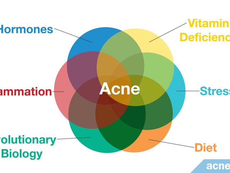 Treating Acne Properly: Why Over-the-Counter Isn't Always Enough