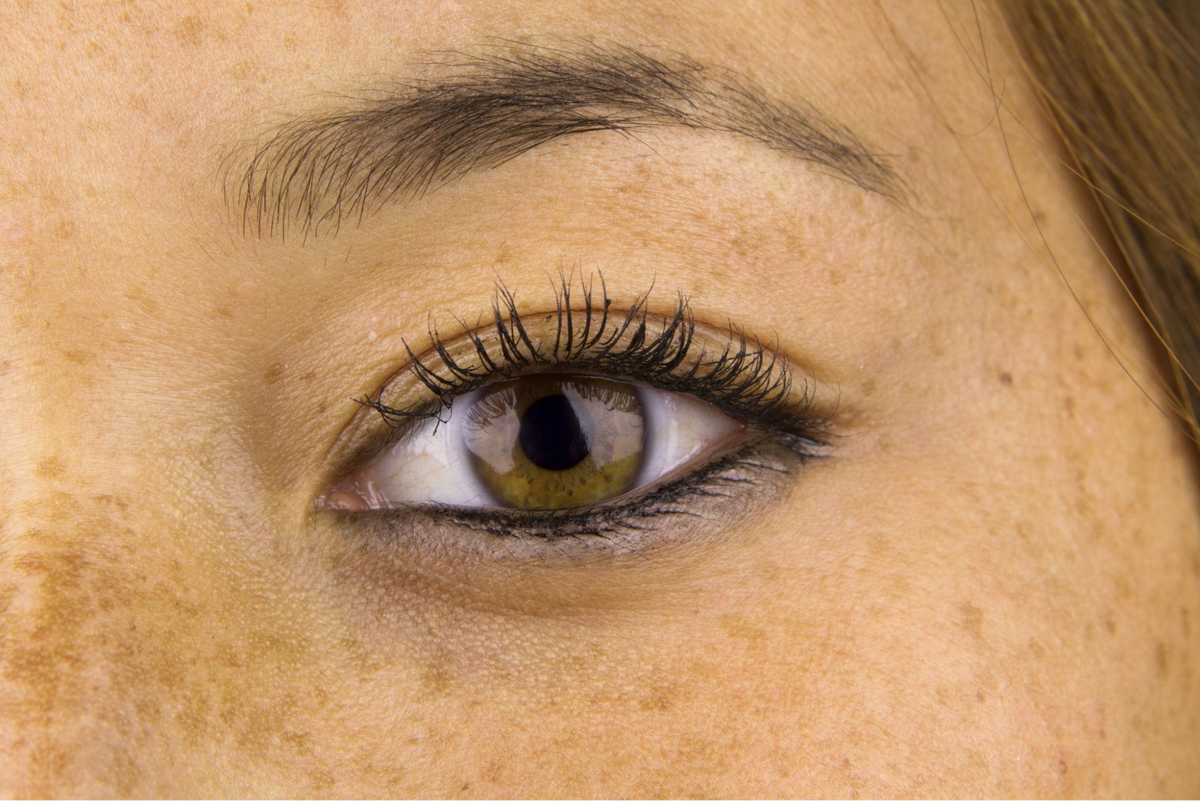 Can Sun Damage Be Reversed? Laser Treatments vs Medical Skincare Explained