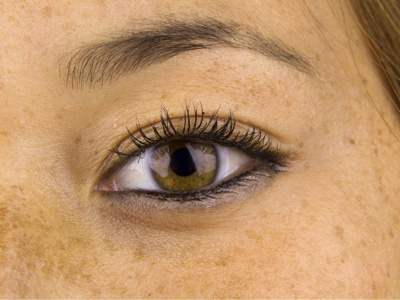 Can Sun Damage Be Reversed? Laser Treatments vs Medical Skincare Explained