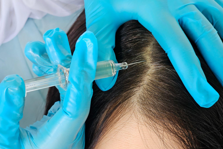 Hair Restoration Treatments: KeraLase, Keravive and Scalp Health Explained