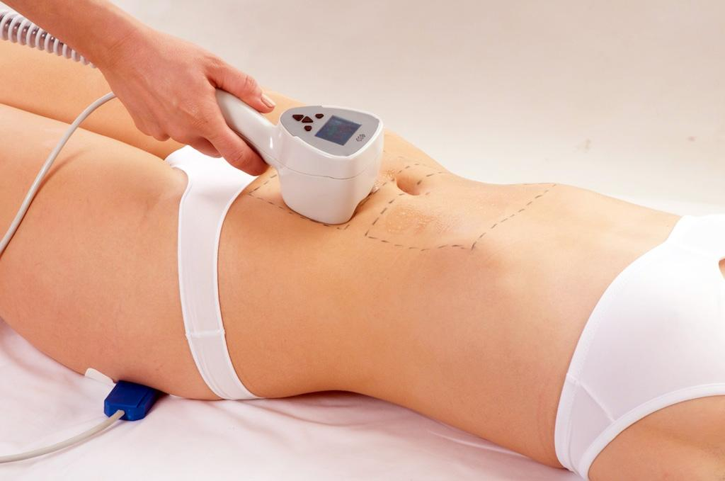 What Is BTL Exilis and When Is It Worth Considering?