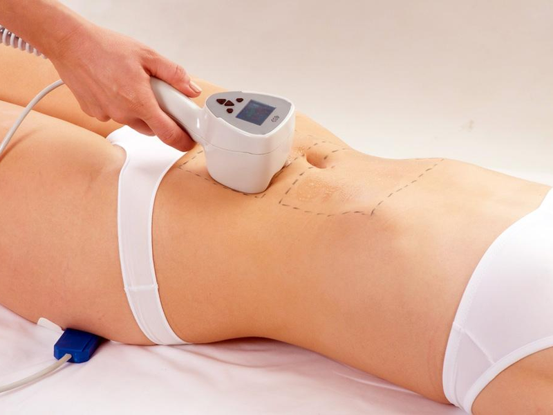 What Is BTL Exilis and When Is It Worth Considering?