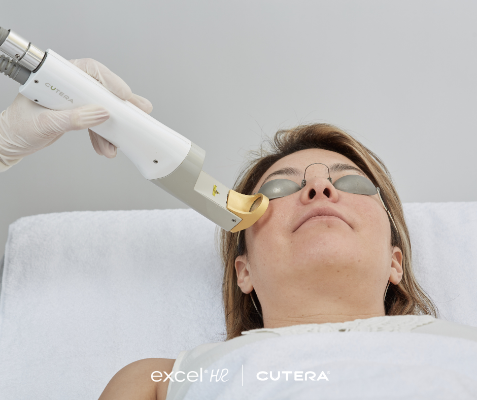 Laser Hair Removal/Excel HR