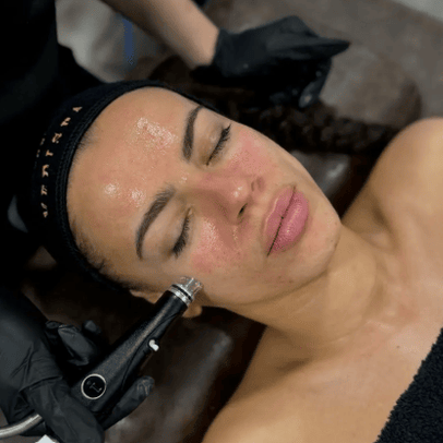 Hydrafacial® – Deep Cleanse + Instant Glow