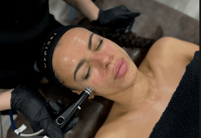 Hydrafacial® – Deep Cleanse + Instant Glow