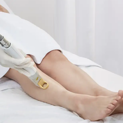 Laser Hair Removal – Permanent Hair Reduction