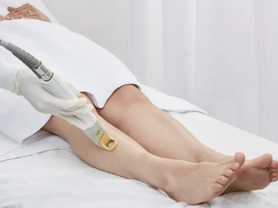 Laser Hair Removal – Permanent Hair Reduction