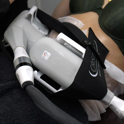 Cristal Pro® Fat Freezing – Targeted Fat Reduction Without Surgery